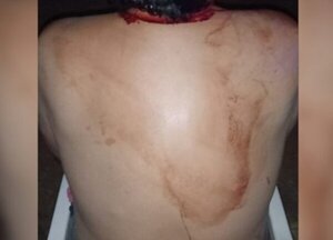 Mujer golpea con martillo a su pareja tras una discusión