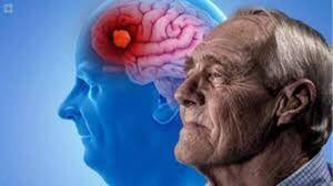 Diario HOY | Alzheimer: importancia de detectar los síntomas iniciales