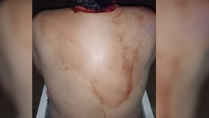DOÑA SE DEFENDIÓ A MARTILLAZOS DE SU PAREJA EN ENCARNACIÓN