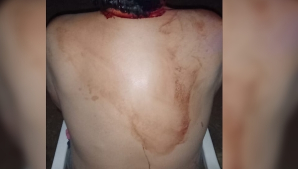 DOÑA SE DEFENDIÓ A MARTILLAZOS DE SU PAREJA EN ENCARNACIÓN