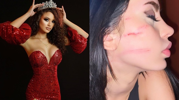 Denuncian a miss por caso de agresión fuera de una discoteca - EPA