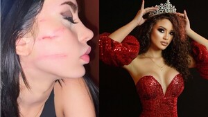 Joven he'i que reina de belleza le garroteó: "Mereces ir presa"