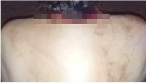 Doña atacó con martillo a su pareja y no la quiso denunciar