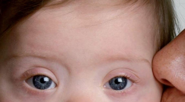 Organizan Congreso de Pediatría para padres de niños con síndrome de down