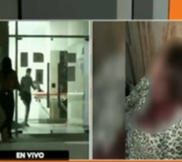 Brutal agresión a una mujer en Limpio - Paraguay.com