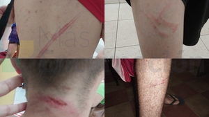 Violencia en la Base Naval: Joven denuncia agresión por parte de militares.