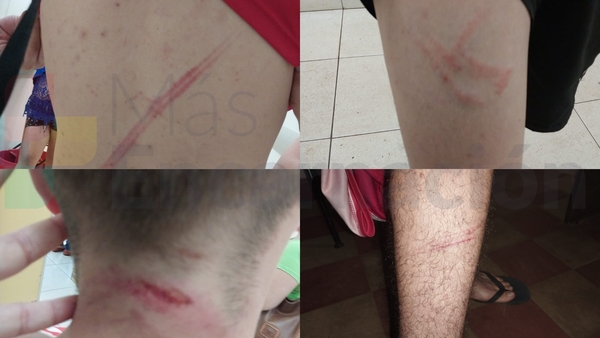 Diario HOY | Joven denuncia haber sido agredido por militares de la Base Naval de Encarnación