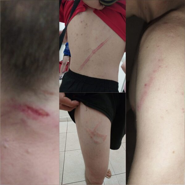 JOVEN DENUNCIA HABER SIDO AGREDIDO POR MILITARES DE LA BASE NAVAL DE ENCARNACIÓN