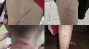 Joven denuncia haber sido agredido por militares de la Base Naval de Encarnación