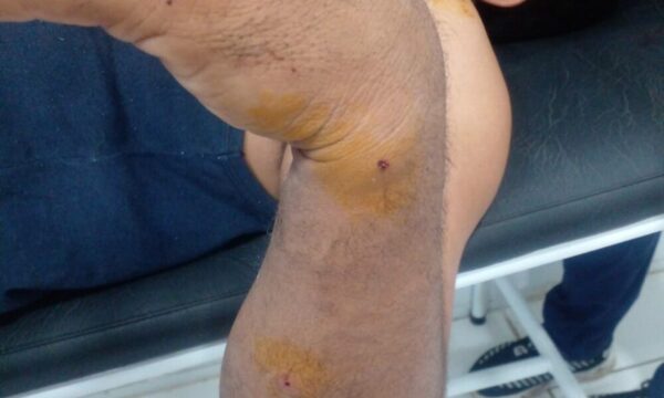Karai ligó balazo por curiosear en las calles de Asunción