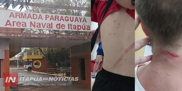 Diario HOY | Armada investiga denuncia de agresión a joven en la Base Naval de Encarnación