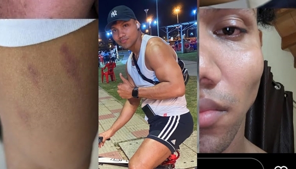 "Tiktoker Veneguayo" fue víctima de una brutal golpiza - Teleshow