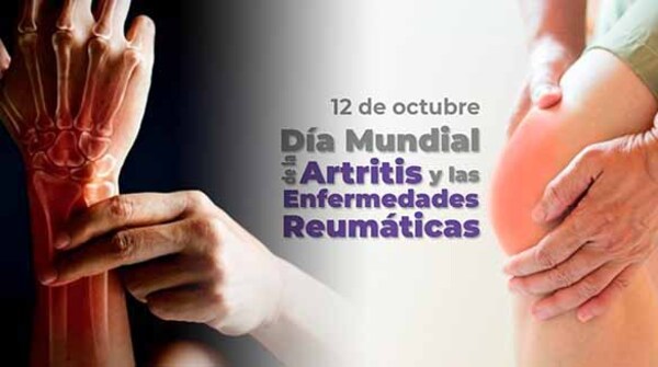 Fundación Tesãi recuerda el Día Mundial de la Artritis y Enfermedades Reumáticas | DIARIO PRIMERA PLANA