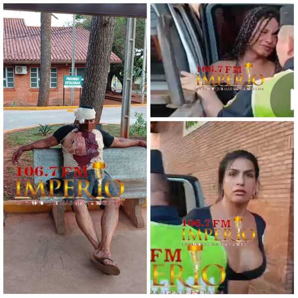 Quiso mediar en pelea ocasionada por mujeres trans y acabó herido de una pedrada - Radio Imperio 106.7 FM
