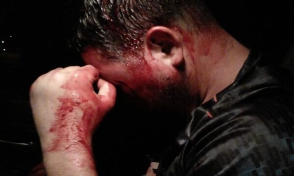 ¡Un hombre fue golpeado con un arma, en intento de asalto!