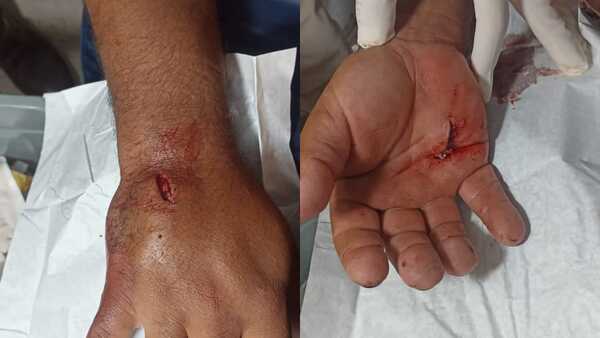 Apuñaló a su jefe porque lo despidió
