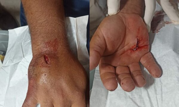 Su jefe lo despidió y lo apuñaló