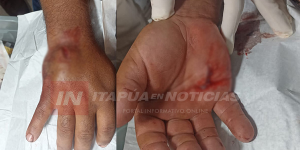 HOMBRE HABRÍA INTENTADO APUÑALAR A SU EX PATRÓN EN ALTO VERÁ - Itapúa Noticias