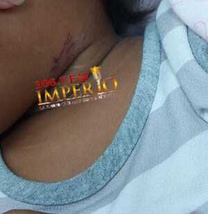 CODENI rescató a una niña de 2 años que presenta rastros de golpes y heridas - Radio Imperio 106.7 FM