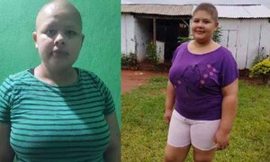 Niña con cáncer sueña con festejar su cumpleaños – Prensa 5