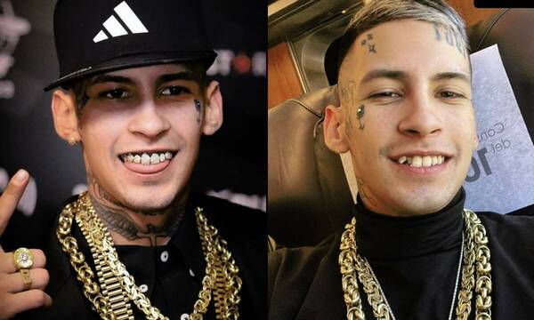 L-Gante tiene oro y diamantes en sus dientes, pero no invierte en arreglarlos