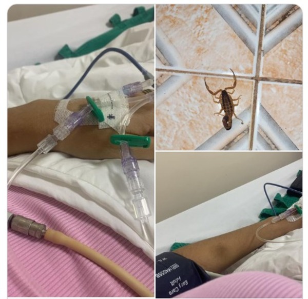 “El dolor era insoportable”, cuenta mujer picada por alacrán