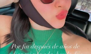Novia de Luis Zarate se sacó la papada y está feliz