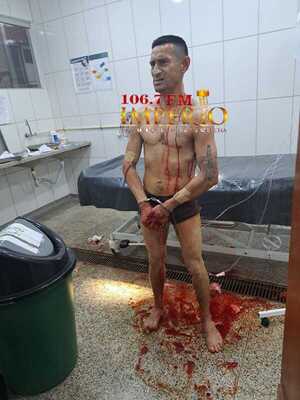 Recluso de la cárcel regional que cumple condena por asesinato fue herido con arma blanca - Radio Imperio 106.7 FM
