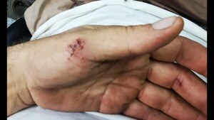 Salud registra 717 accidentes por animales ponzoñosos en lo que va del año - Oasis FM 94.3