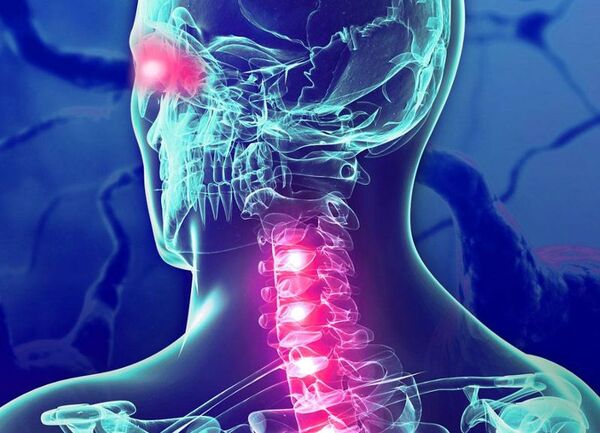 Diario HOY | IPS ofrece tratamiento a pacientes con Neuromielitis óptica
