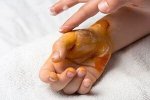 Diario HOY | Lugares de la casa en donde los niños pueden sufrir heridas, quedar deformes o morir