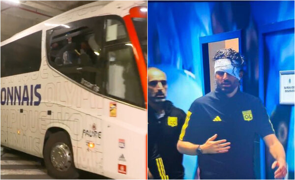 Versus / Apedrearon el bus del Lyon en Marsella y su entrenador fue herido