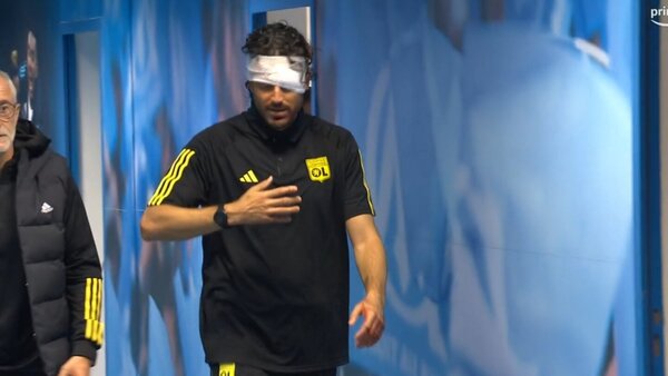 El autobús del Lyon, apedreado; el técnico Fabio Grosso, herido