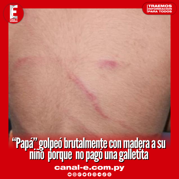 “Papá” golpeó brutalmente con madera a su niño porque no pagó una galletita