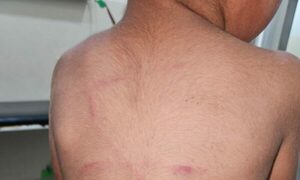 Denuncian que hombre reventó a garrotazos a su hijo por una galletita