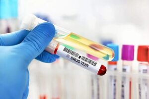 Prueba sobre consumo de drogas: cómo se hace, cuánto cuesta y qué detecta - Nacionales - ABC Color