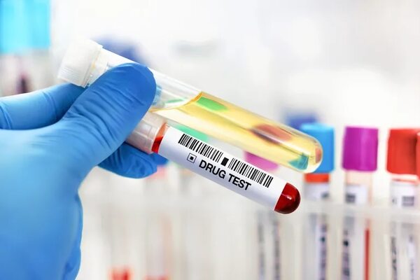 Prueba sobre consumo de drogas: cómo se hace, cuánto cuesta y qué detecta - Nacionales - ABC Color