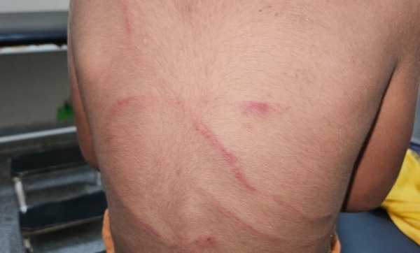 Hombre reventó a garrotazos a su hijo por una galletita - Noticiero Paraguay