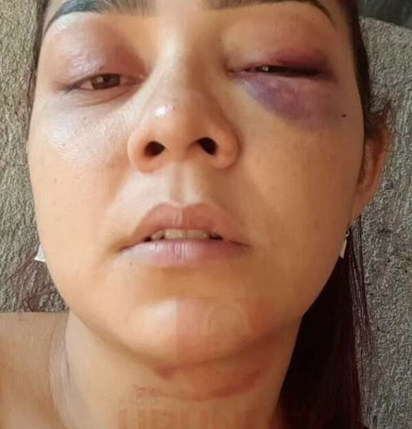 Suegro reventó a golpes a su nuera tras una discusión