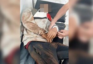 Murió motochorro que había sido atropellado por su víctima - ABC en el Este - ABC Color