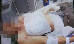 Derramaron combustible e incendiaron a un hombre y ahora lucha por su vida