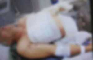 Broma casi termina en tragedia en Encarnación