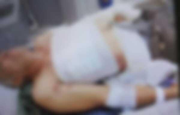 Broma casi termina en tragedia en Encarnación