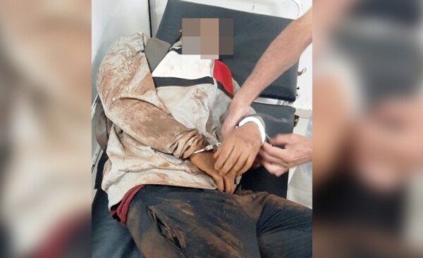 Murió motochorro que fue atropellado por su víctima