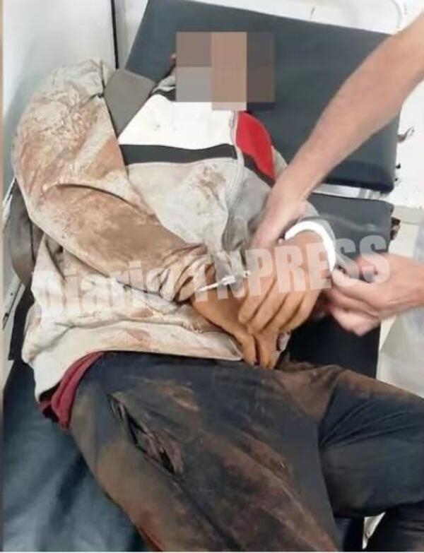 Murió motochorro que había sido atropellado por su víctima – Diario TNPRESS