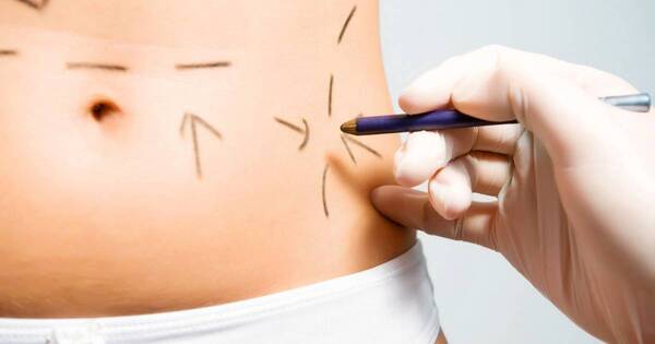 La Nación / Medicina estética: gremio solicita mesa de trabajo sobre proyecto de ley