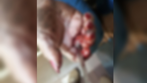 Mujer gravemente herida en brutal ataque con cuchillo en Carlos A. López