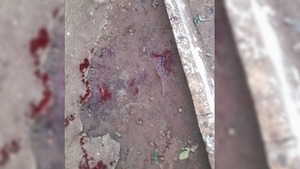 Joven apuñalado en fiesta bailable en Tomás Romero Pereira