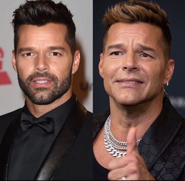 Nueva cara de Ricky Martin, y por supuesto, los memes