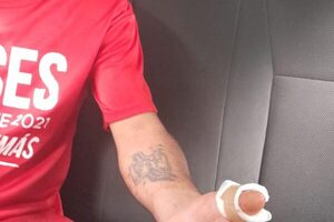 Su propia madre le cortó el dedo